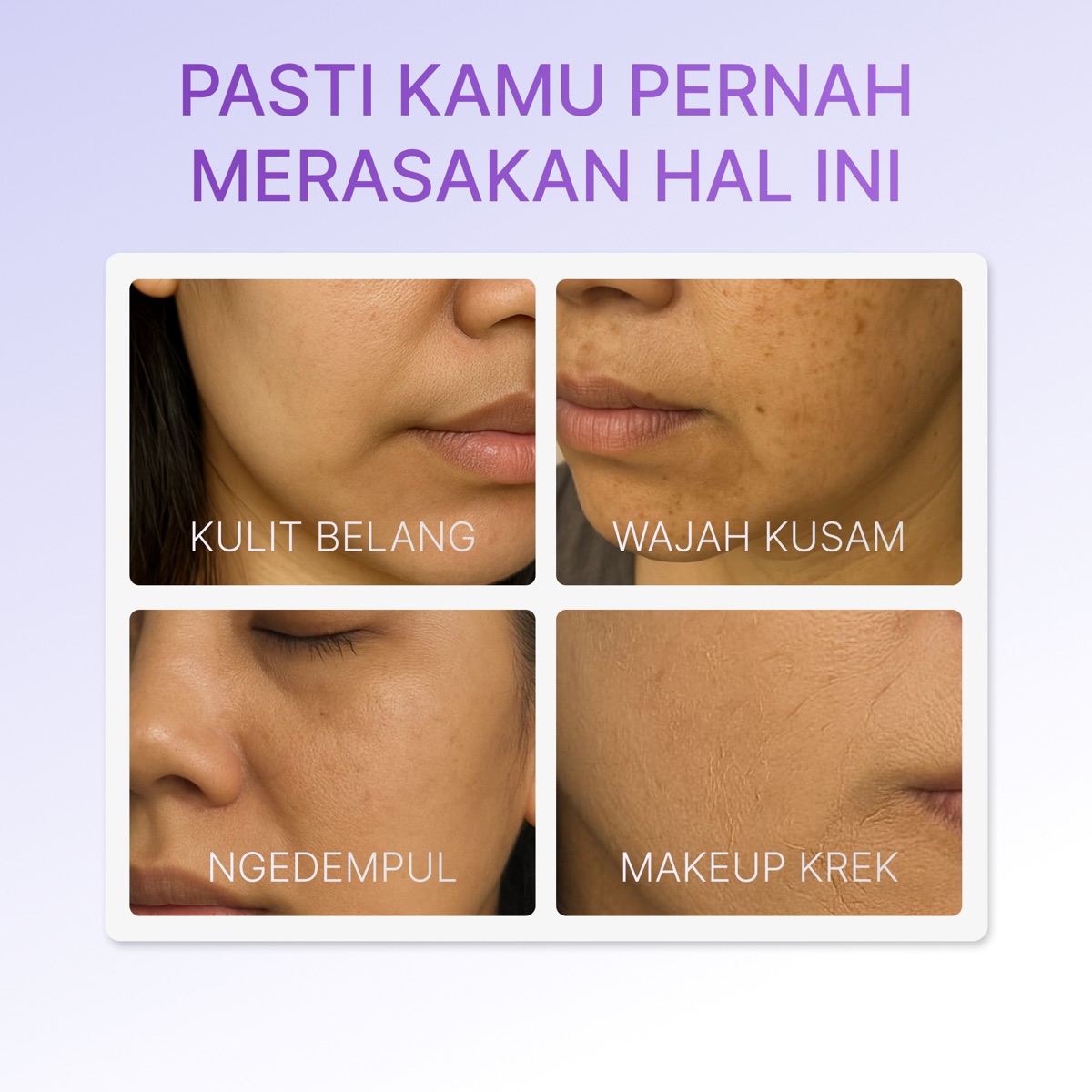 Ozzaskin Advanced Whitening Day Cream foto 2