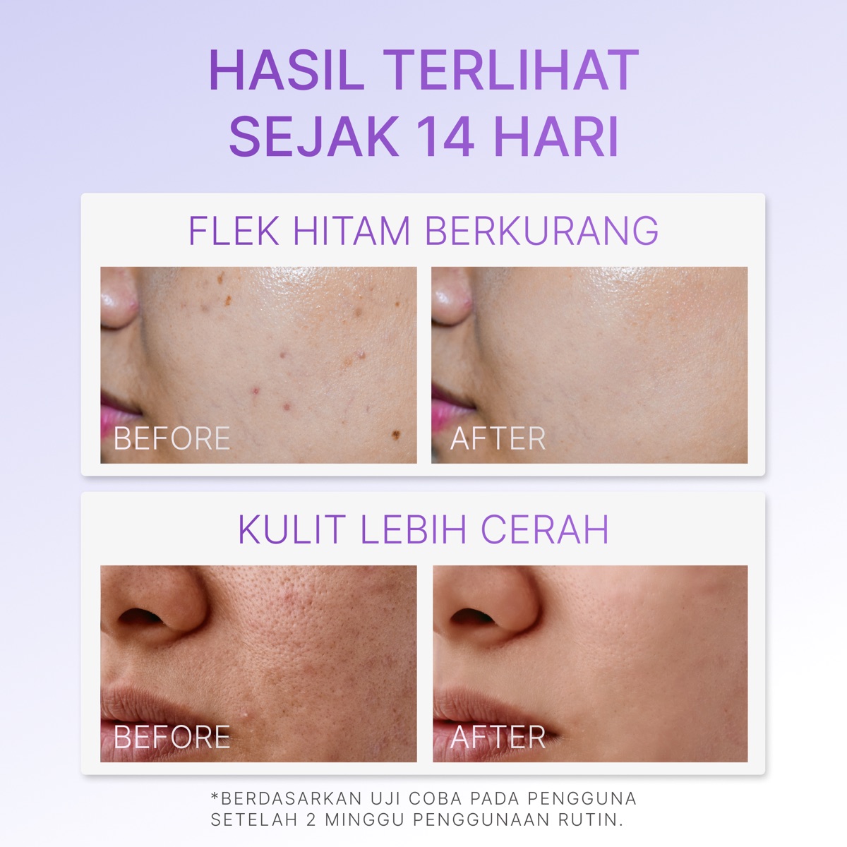 Ozzaskin Advanced Whitening Day Cream foto 6